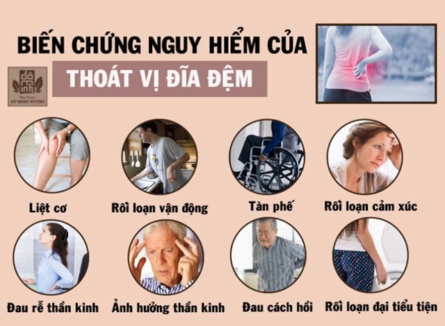 Những Biến Chứng Của Bệnh Thoát Vị Đĩa Đệm