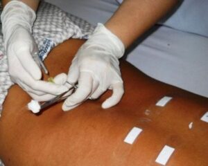 Hình ảnh Các Phương Pháp Chữa Thoát Vị Đĩa Đệm