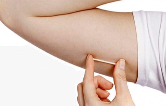 Hình ảnh minh họa que tránh thai Implanon tại BV Hồng Hà