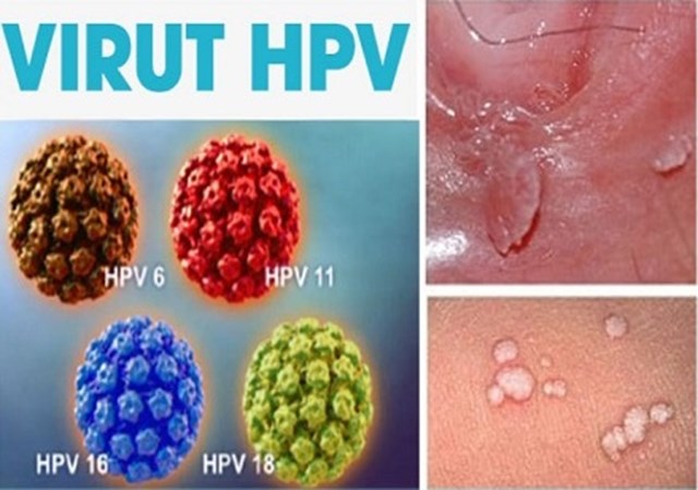 Cùng tìm hiểu các vấn đề liên quan đến tầm soát ung thư cổ tử cung sớm