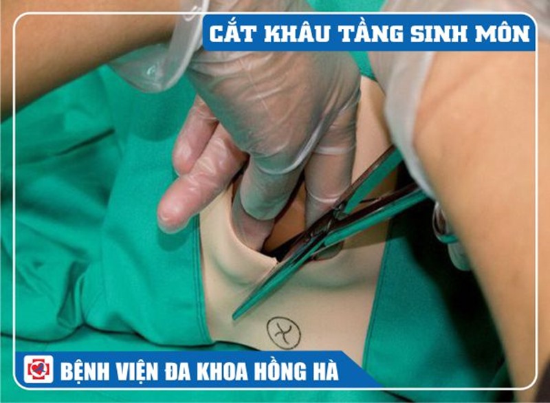 Hình Minh Hoạ Cắt Khâu Tầng Sinh Môn