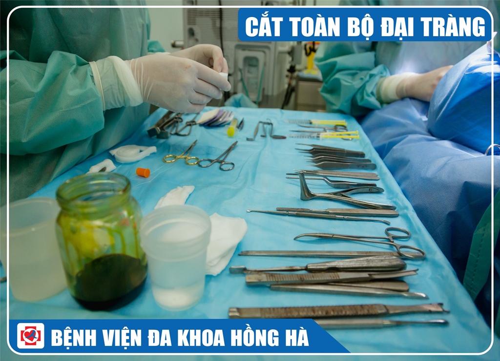 Hình Minh Hoạ Cắt Toàn Bộ Đại Tràng
