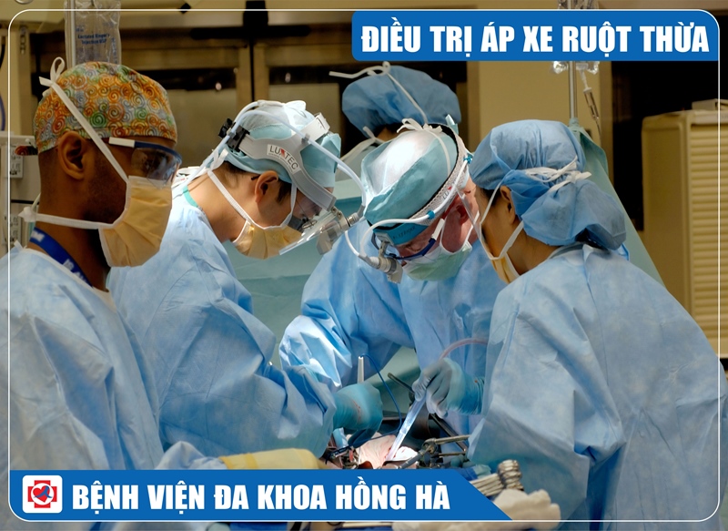 Hình Minh Hoạ Điều Trị Áp Xe Ruột Thừa Trong Ổ Bụng Bằng Phẫu Thuật Nội Soi