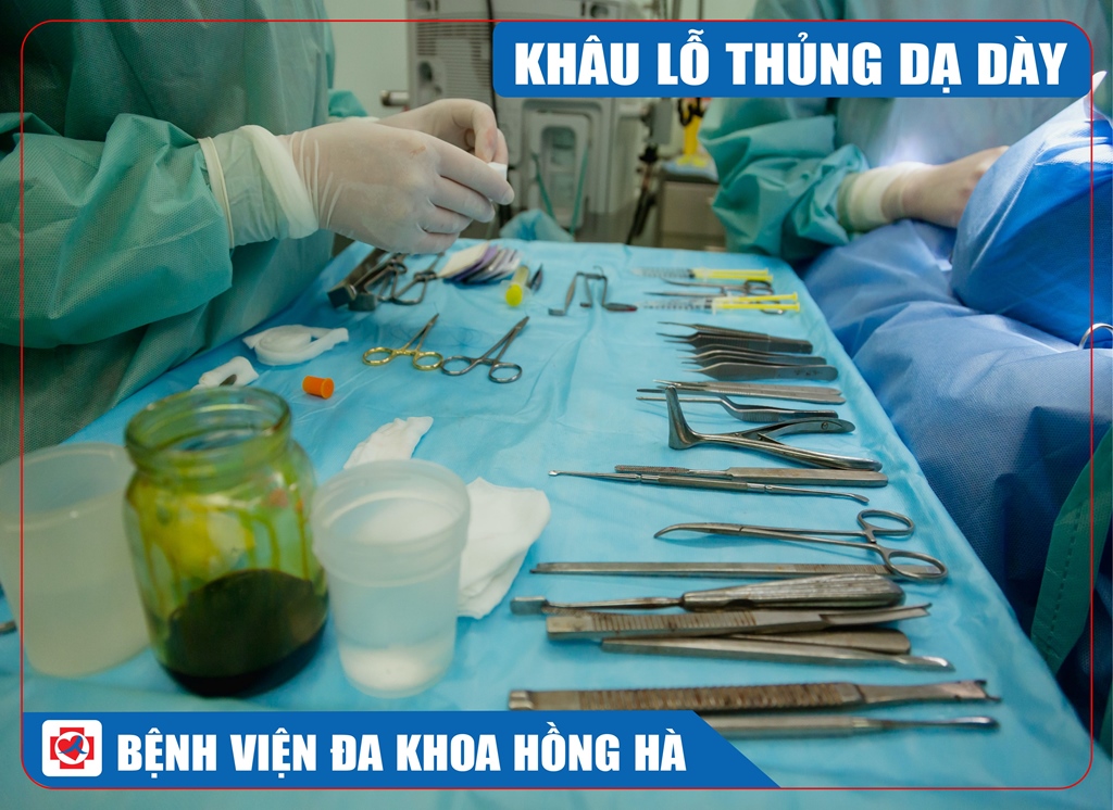Hình Minh Hoạ Khâu Lỗ Thủng Dạ Dày Hành Tá Tràng