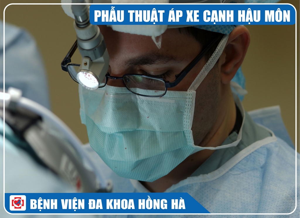 Hinh minh hoạ phẫu thuật áp xe cạnh hậu môn