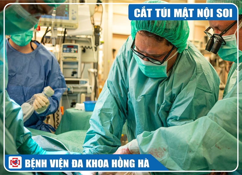 Hình Minh Hoạ Phẫu Thuật Cắt Túi Mật Nội Soi