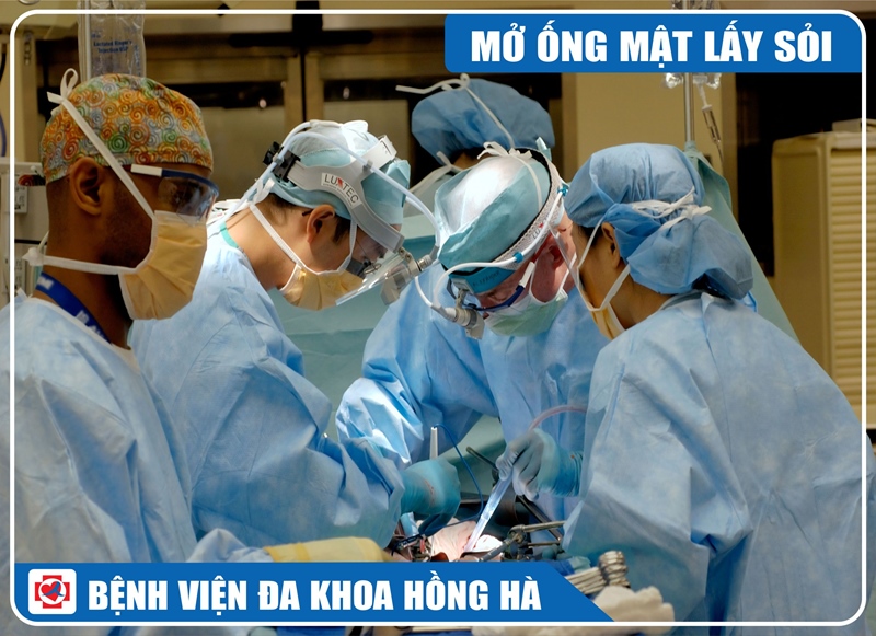 Hình Minh Hoạ Phẫu Thuật Mở Ống Mật Chủ Lấy Sỏi Nội Soi