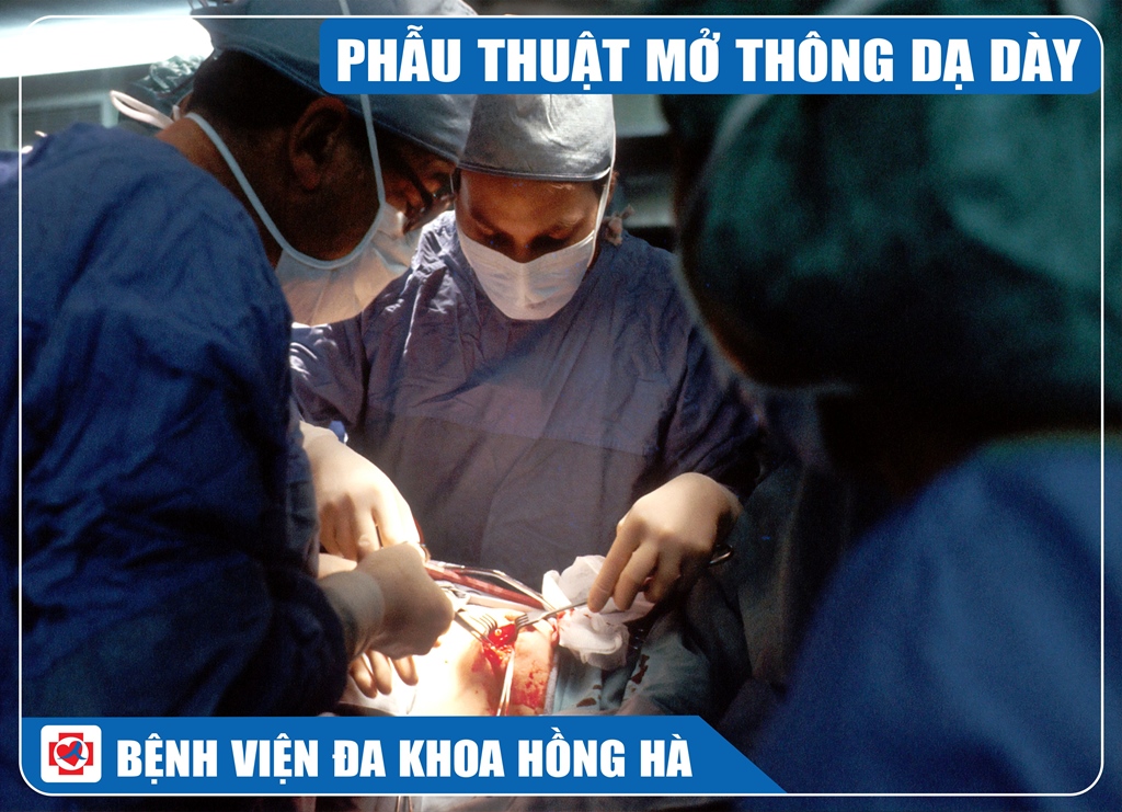 Ảnh Minh Hoạ Phẫu Thuật Mở Thông Dạ Dày