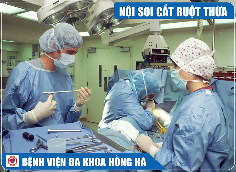 Hình Minh Hoạ Phẫu Thuật Cắt Ruột Thừa Nội Soi Ổ Bụng