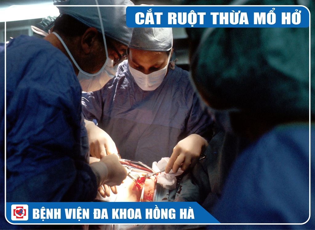Hình Minh Hoạ Cắt Ruột Thừa Mổ Mở
