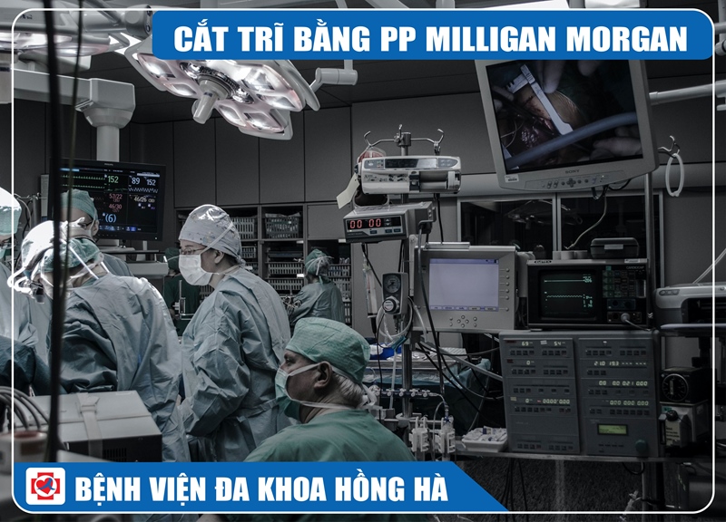 Ảnh minh hoạ cắt trĩ bằng phương pháp milligan - morgan