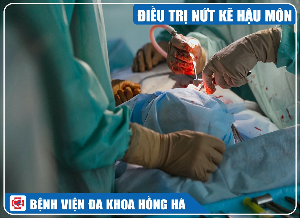 Ảnh Minh Hoạ Điều Trị Nứt Kẽ Hậu Môn