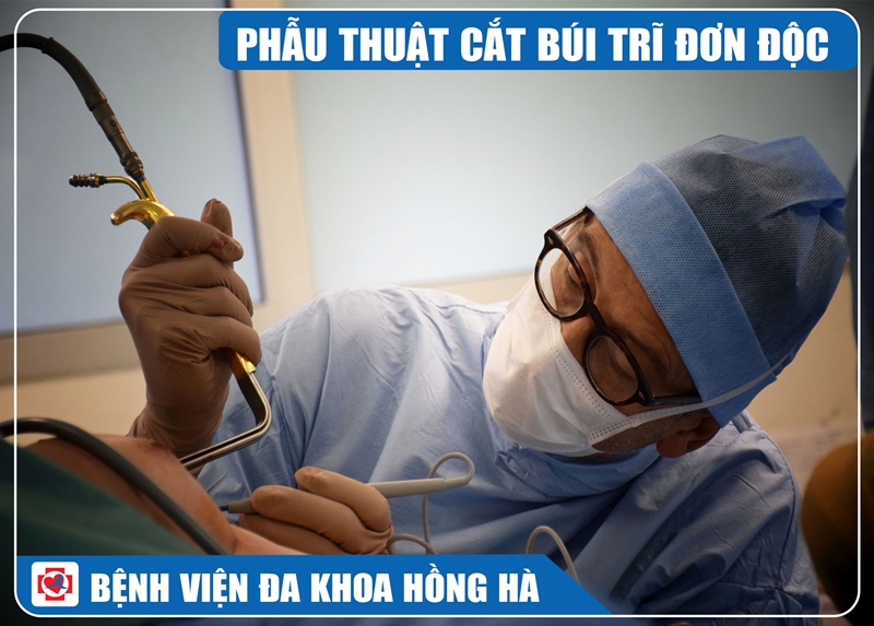 Ảnh minh hoạ phẫu thuật cắt búi trĩ đơn độc