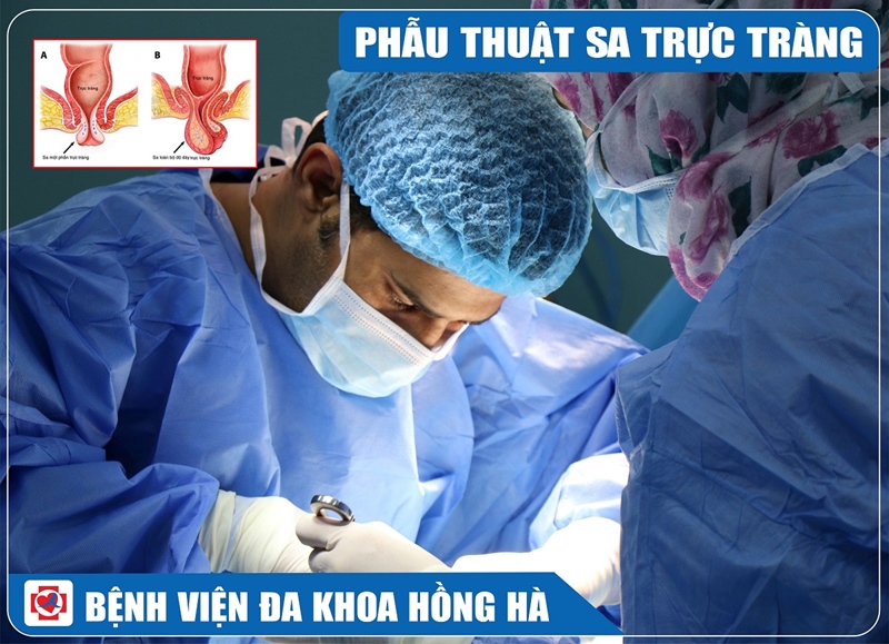 Ảnh minh hoạ phẫu thuật sa trực tràng người lớn đường bụng