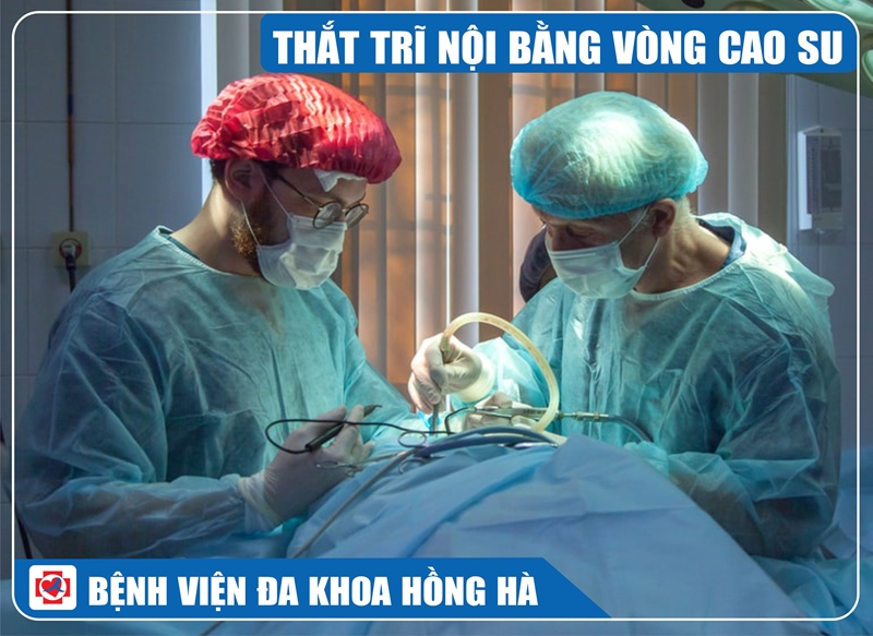 Ảnh minh hoạ thắt trĩ nội bằng vòng cao su