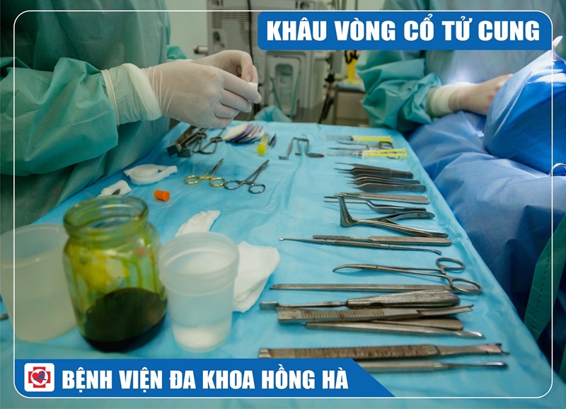 Hình Minh Hoạ Khâu Vòng Cổ Tử Cung