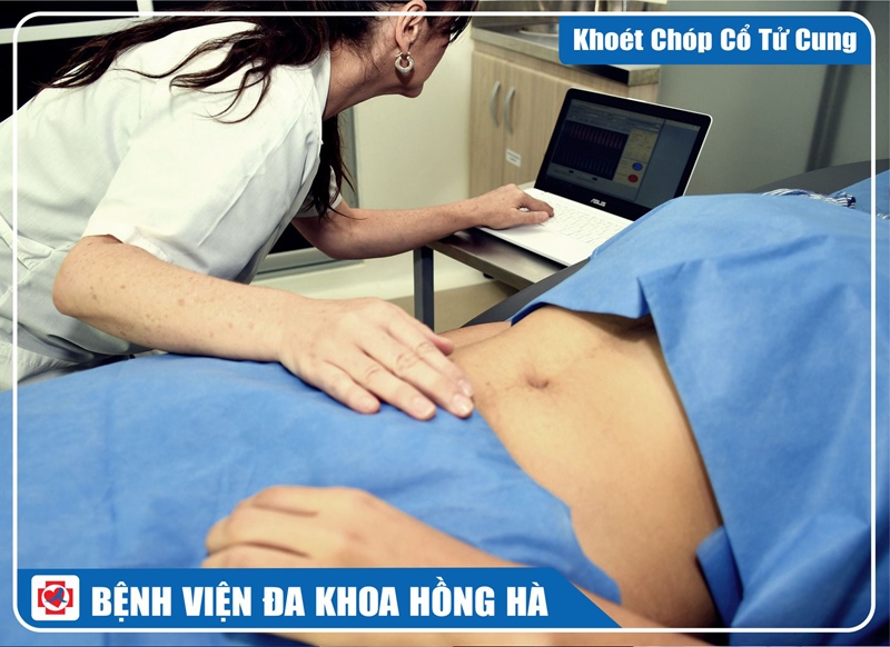 Hình minh hoạ Khoét Chóp Cổ Tử Cung