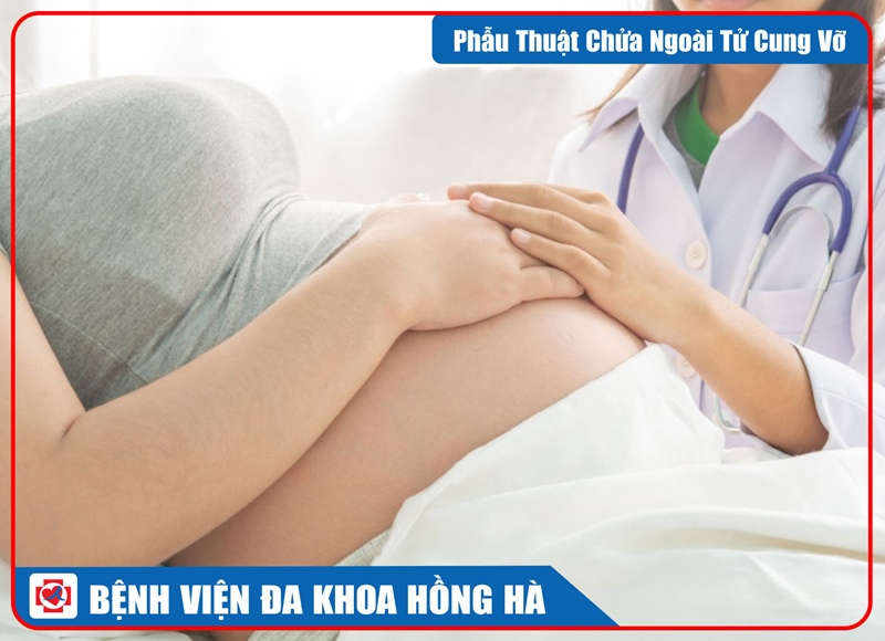 Hình Minh Hoạ Phẫu Thuật Chửa Ngoài Tử Cung Vỡ