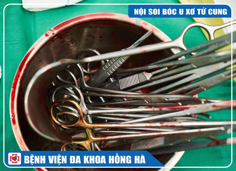 Hình Minh Hoạ Phẫu Thuật Nội Soi Bóc U Xơ Tử Cung