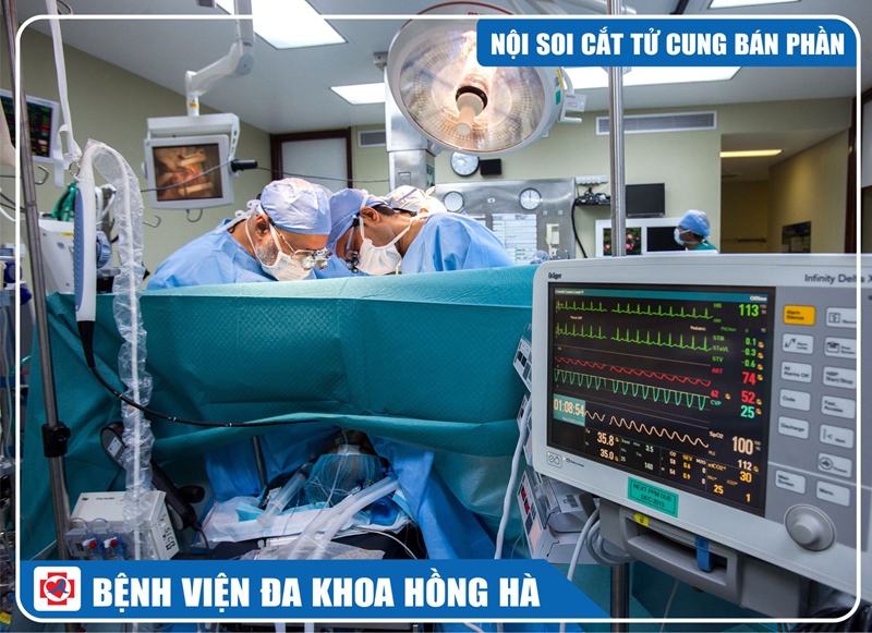 Hình Minh Hoạ Phẫu Thuật Nội Soi Cắt Tử Cung Bán Phần