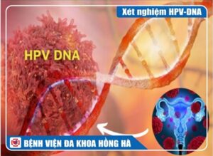 xét nghiệm HPV-DNA trong tầm soát ung thư cổ tử cung