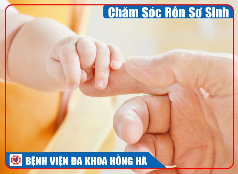 Hình Minh Hoạ Chăm Sóc Rốn Sơ Sinh