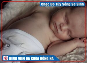 Chọc Dò Tủy Sống Sơ Sinh