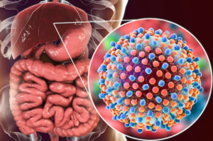 Hình ảnh viêm gan C