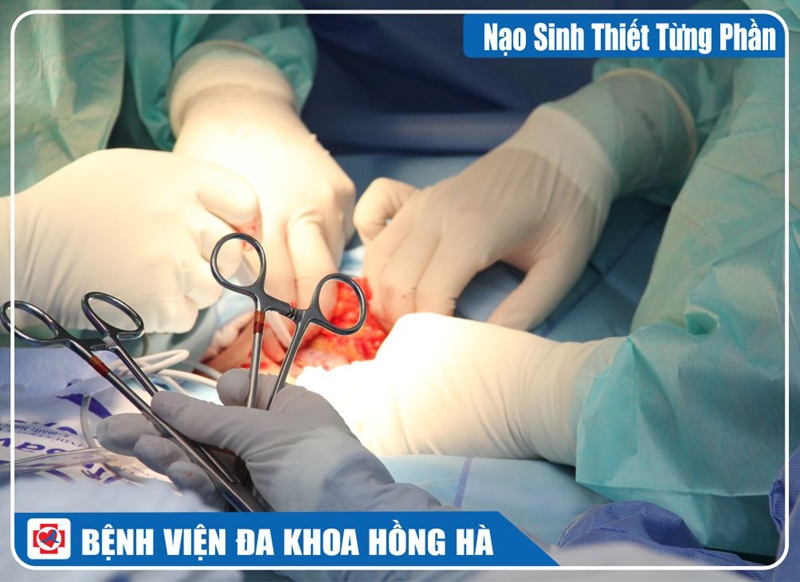 Hình Minh Hoạ Nạo Sinh Thiết Từng Phần
