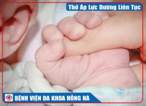 Thở Áp Lực Dương Liên Tục (Cpap)