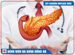 XÉT NGHIỆM AMYLASE MÁU LÀ GÌ ?