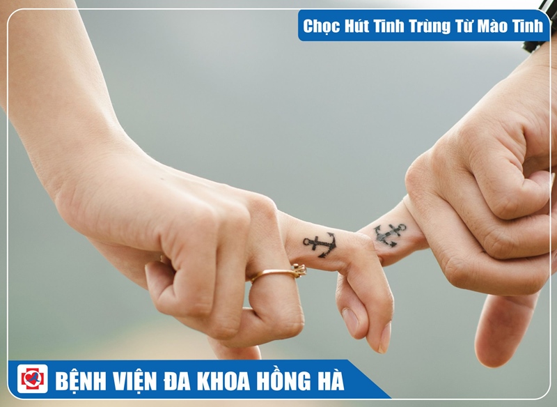 Hình Minh Hoạ Chọc Hút Tinh Trùng Từ Mào Tinh