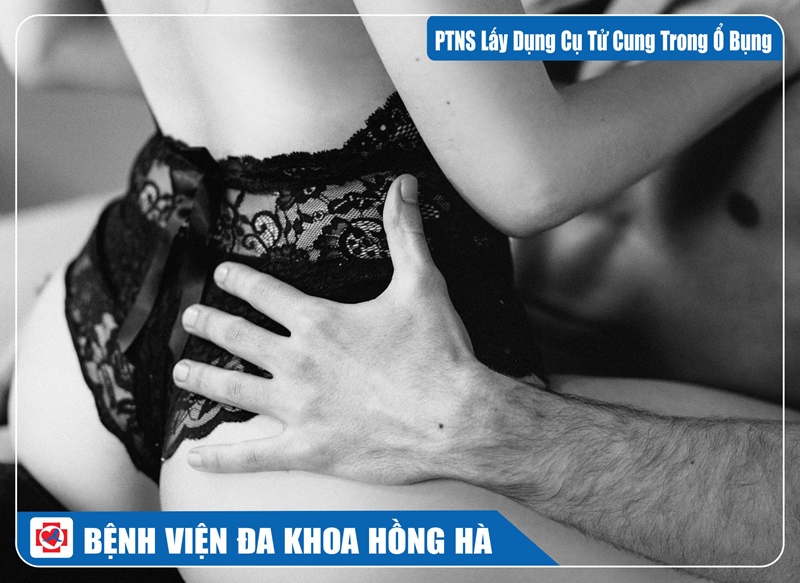 Phẫu Thuật Nội Soi Lấy Dụng Cụ Tử Cung Trong Ổ Bụng