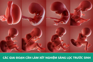 các giai đoạn làm sàng lọc trước sinh