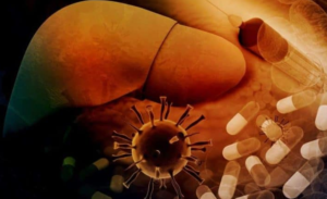 Viêm gan C là căn bệnh gây nhiều biến chứng và phải điều trị trong thời gian dài