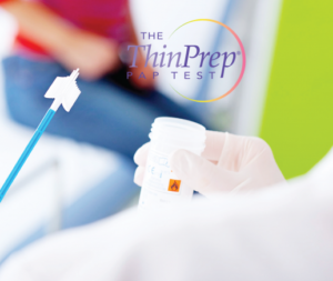 Hình ảnh lấy mẫu xét nghiệm ThinPrep