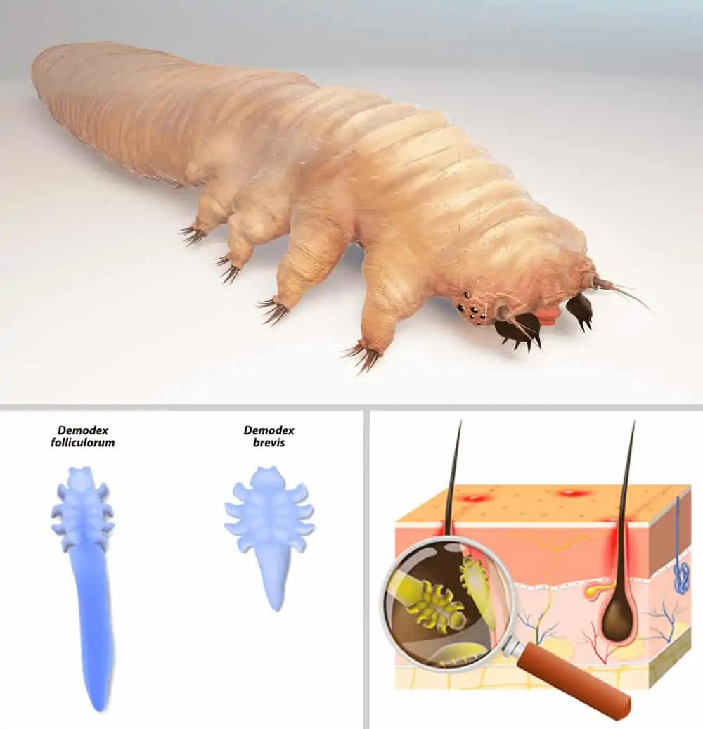 Hình ảnh minh hoạ kí sinh trùng Demodex