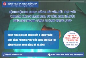 Điều Trị U Lành Tuyến Giáp Bằng Đốt Sóng Cao Tần