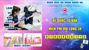 Hình minh họa Làm Gì Khi Răng Khôn Mọc Lệch