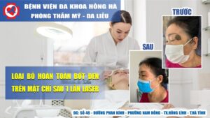 Loại Bỏ Hoàn Toàn Bớt Đen Trên Mặt Chỉ Sau 1 Lần Laser