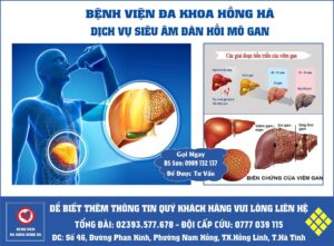 Hình minh hoạ Siêu âm đàn hồi mô gan hồng lĩnh