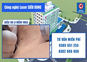 Anh Đai Diện Điều Trị U Mềm Treo Tại Bvđk Hồng Hà