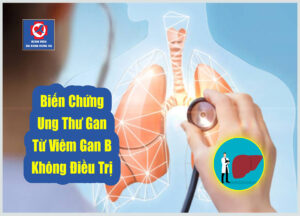 Ảnh đại diện Biến Chứng Ung Thư Gan Từ Viêm Gan B Không Điều Trị