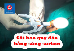 Ảnh đại diện Cắt bao quy đầu bằng súng surkon tại BVĐK Hồng Hà