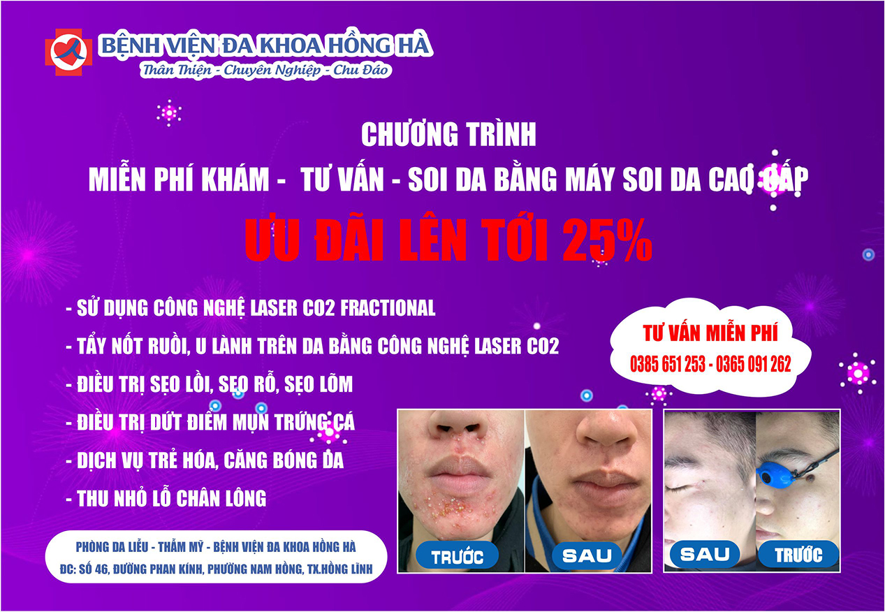 Ảnh đại diện chương trình Khuyến mãi 25% các dịch vụ làm đẹp