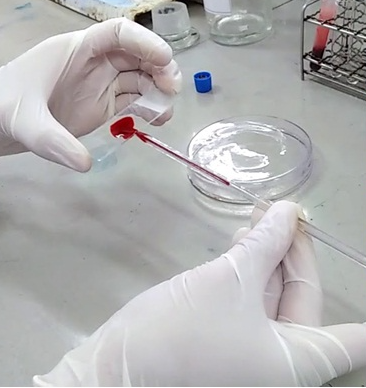 Hình minh họa bài viết Xét Nghiệm Máu Lắng