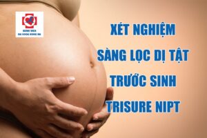Xét Nghiệm Sàng Lọc Dị Tật Trước Sinh Trisure Nipt