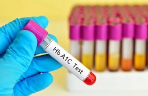 Xét Nghiệm Hba1c Và Những Điều Cần Biết
