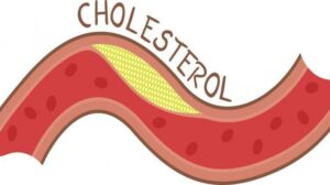 Hình minh hoạ Xét Nghiệm Cholesterol