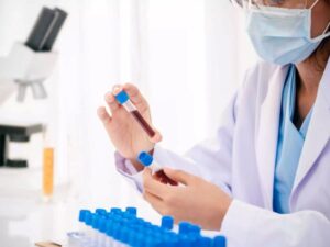 Hình minh hoạ Xét Nghiệm Sắt Huyết Thanh